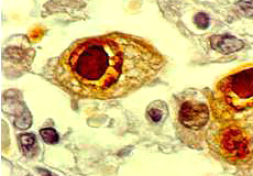 Cytomegalic-cells-breder